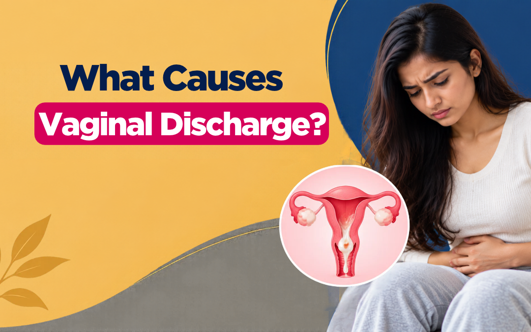 What Causes Vaginal Discharge?